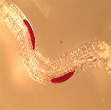 Juveniles de G. pallida (nematodo del quiste pálido) dentro de una raíz de una papa (LM Dandurand)